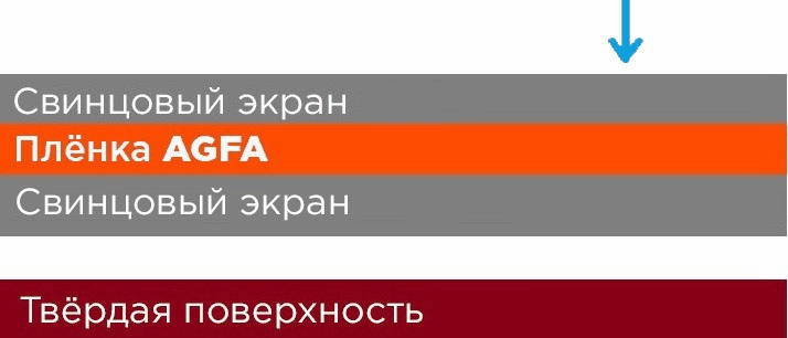 Как выбрать усиливающие экраны фото 3